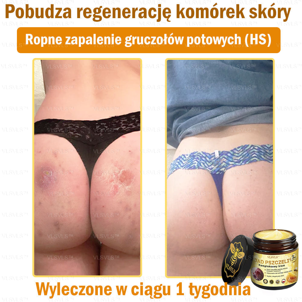 VLSVLS™ Krem Komprehensywny z Jadami Pszczół 👩⚕️ Rekomendowany przez Dermatologów