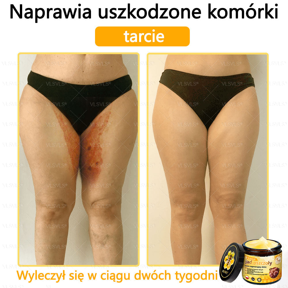 VLSVLS® Krem z jadem pszczelim do regeneracji skóry (👨⚕ odpowiedni dla wszystkich grup wiekowych, polecany przez AAD)