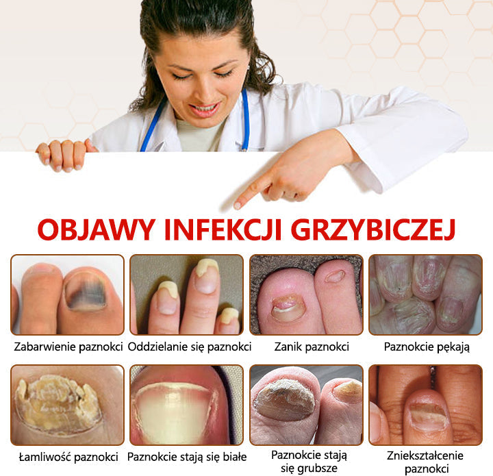 Spray z jadem pszczelim – skuteczny w leczeniu infekcji grzybiczych i zapalenia paznokci🐝