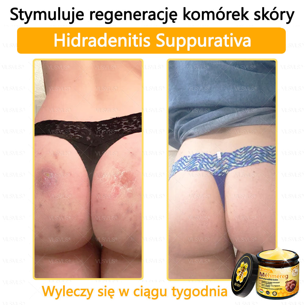 VLSVLS® Krem z jadem pszczelim do regeneracji skóry (👨⚕ odpowiedni dla wszystkich grup wiekowych, polecany przez AAD)