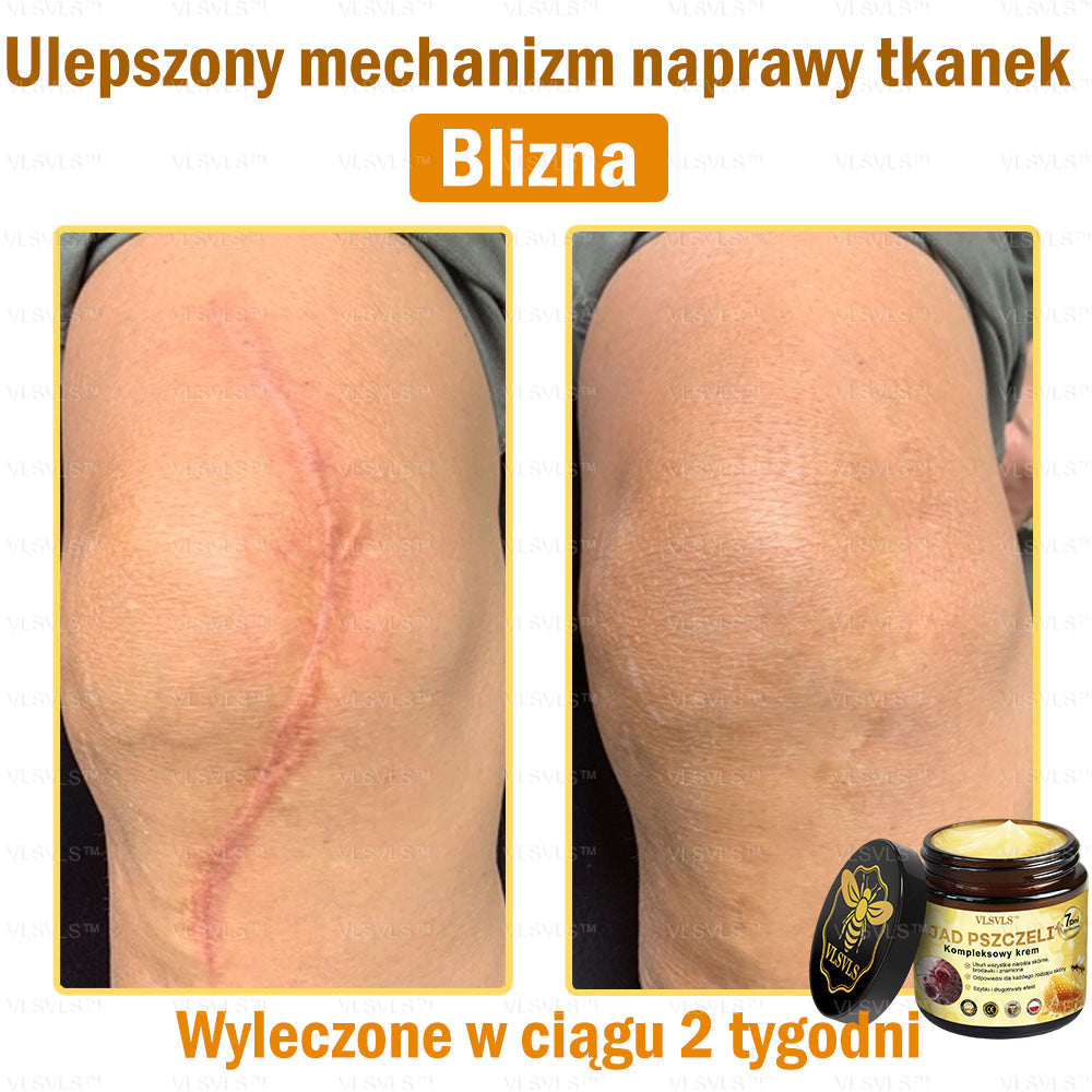 VLSVLS™ Krem Komprehensywny z Jadami Pszczół 👩⚕️ Rekomendowany przez Dermatologów