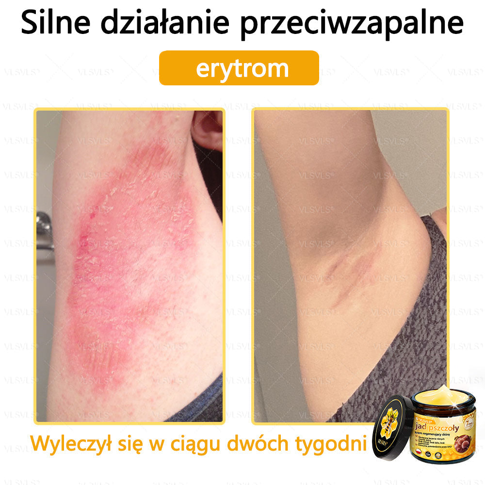 VLSVLS® Krem z jadem pszczelim do regeneracji skóry (👨⚕ odpowiedni dla wszystkich grup wiekowych, polecany przez AAD)