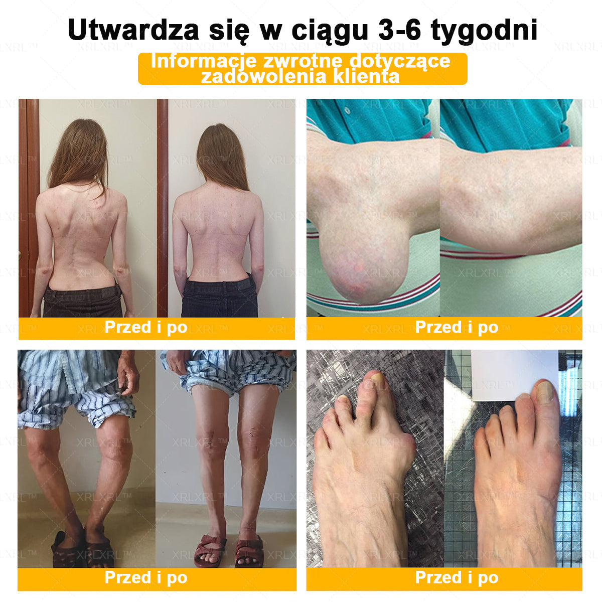 XRLXRL® Jad pszczeli Maść przeciwbólową wspomagającą gojenie kości 🎉🌸(Szczególnie dla osób starszych i zalecane przez EFORT)