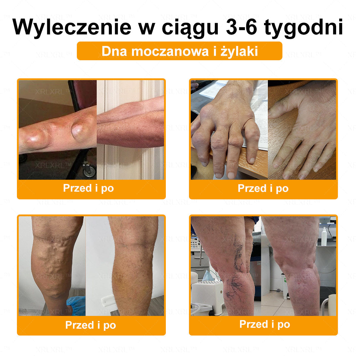 XRLXRL® Jad pszczeli Maść przeciwbólową wspomagającą gojenie kości 🎉🌸(Szczególnie dla osób starszych i zalecane przez EFORT)