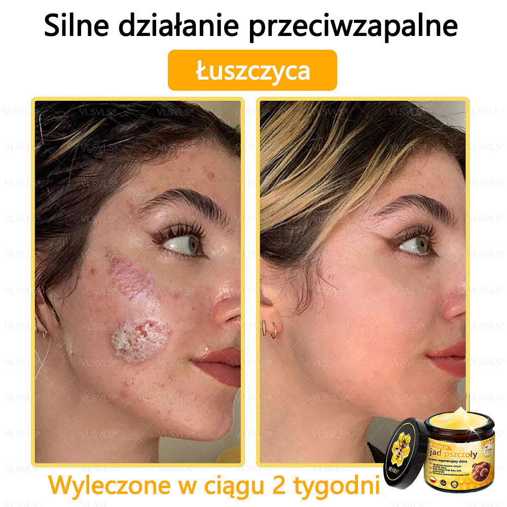 VLSVLS® Krem z jadem pszczelim do regeneracji skóry (👨⚕ odpowiedni dla wszystkich grup wiekowych, polecany przez AAD)