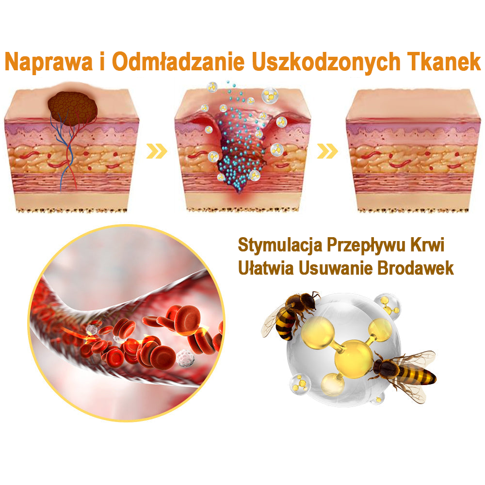 ⭐flysmus™ Sprej z jadem pszczelim do usuwania brodawek i znamion skórnych 🐝🐝🐝