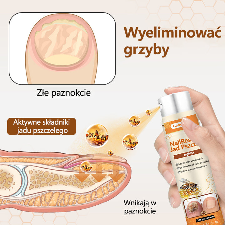 Spray z jadem pszczelim – skuteczny w leczeniu infekcji grzybiczych i zapalenia paznokci🐝