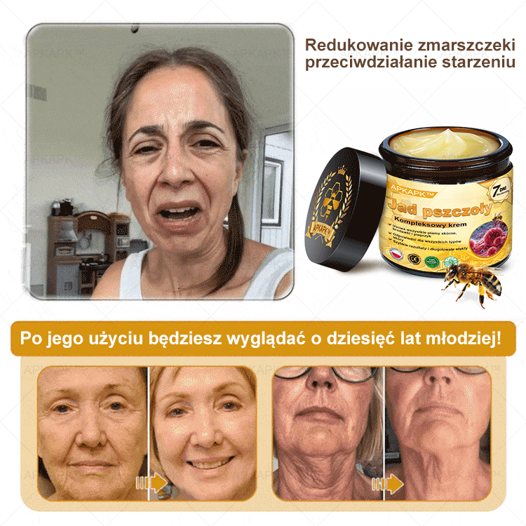 ΑPΚΑPK™ Jad Pszczoły Kompleksowy Krem🥇🥇pomaga w leczeniu problemów skórnych, takich jak: zmarszczki, blizny, plamy pigmentacyjne, rozstępy, trądzik, łuszczyca, egzema, zmiany skórne, podrażnienia, stany zapalne i inne problemy skórne🔥