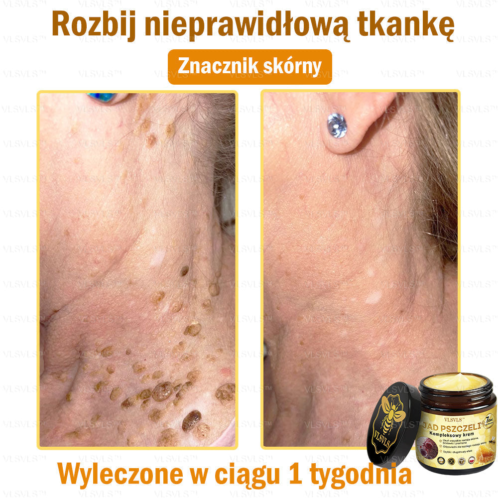 VLSVLS™ Krem Komprehensywny z Jadami Pszczół 👩⚕️ Rekomendowany przez Dermatologów