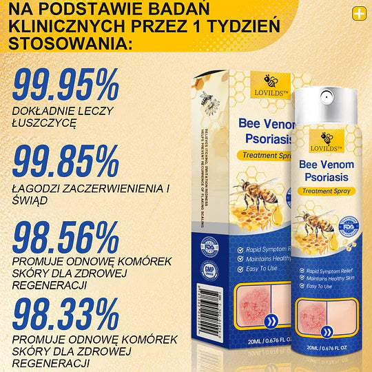 (🔥Płatność przy odbiorze🔥70% zniżki) LOVILDS™ PsoriaHeal Spray na łuszczycę (wysyłka na cały świat – bezpłatna wysyłka)🌐