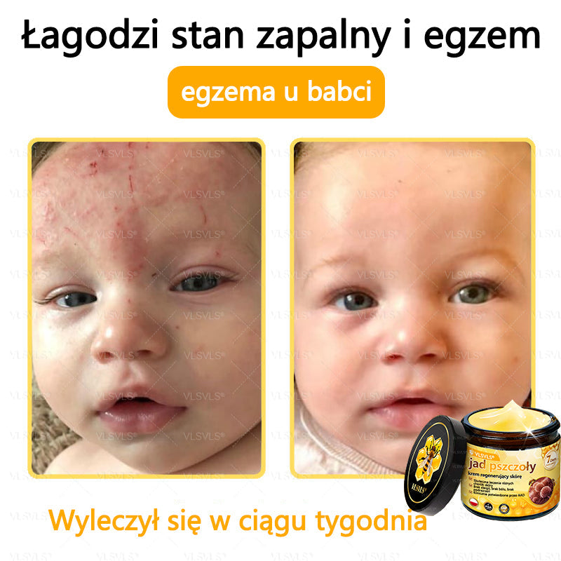 VLSVLS® Krem z jadem pszczelim do regeneracji skóry (👨⚕ odpowiedni dla wszystkich grup wiekowych, polecany przez AAD)