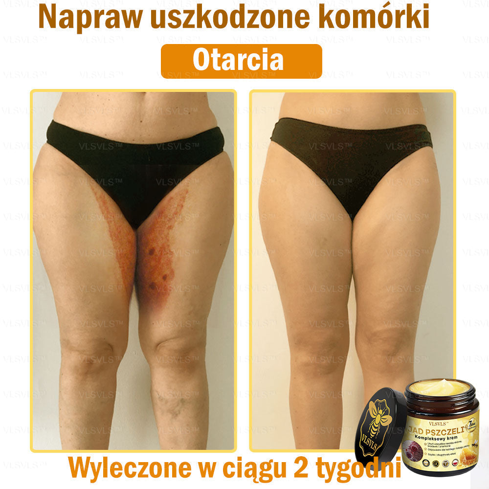 VLSVLS™ Krem Komprehensywny z Jadami Pszczół 👩⚕️ Rekomendowany przez Dermatologów