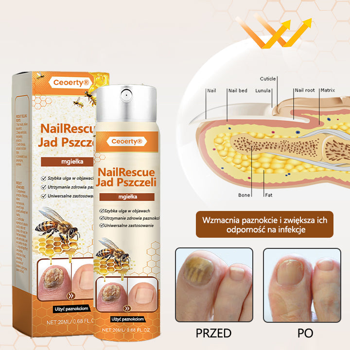 Spray z jadem pszczelim – skuteczny w leczeniu infekcji grzybiczych i zapalenia paznokci🐝
