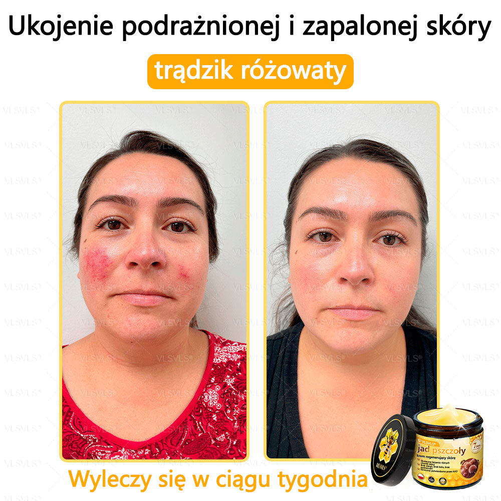 VLSVLS® Krem z jadem pszczelim do regeneracji skóry (👨⚕ odpowiedni dla wszystkich grup wiekowych, polecany przez AAD)