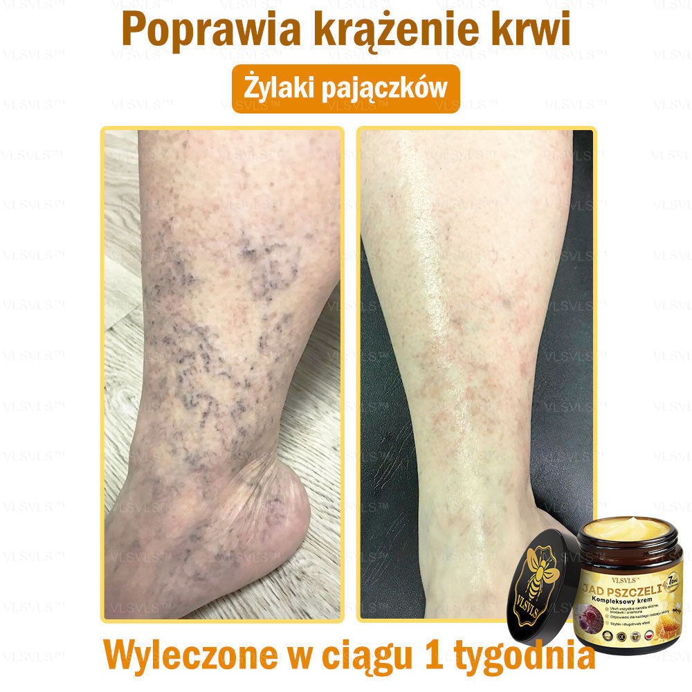 VLSVLS™ Krem Komprehensywny z Jadami Pszczół 👩⚕️ Rekomendowany przez Dermatologów
