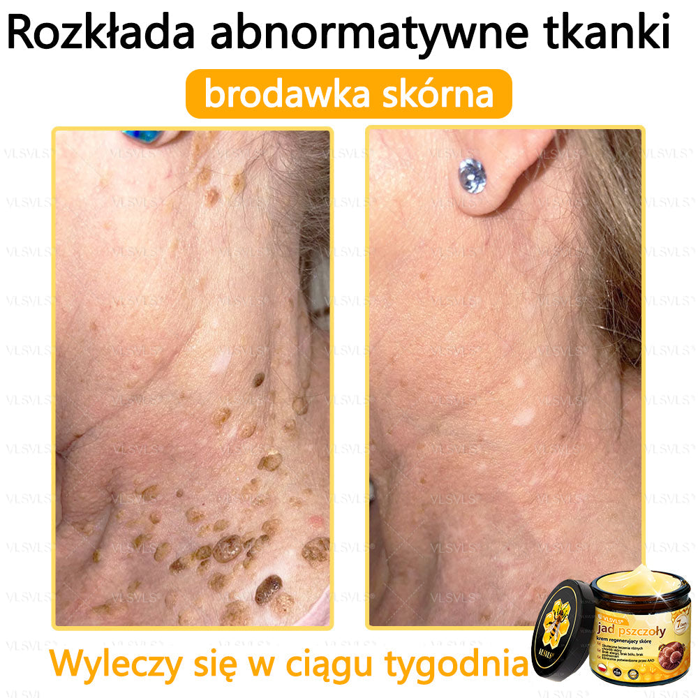 VLSVLS® Krem z jadem pszczelim do regeneracji skóry (👨⚕ odpowiedni dla wszystkich grup wiekowych, polecany przez AAD)