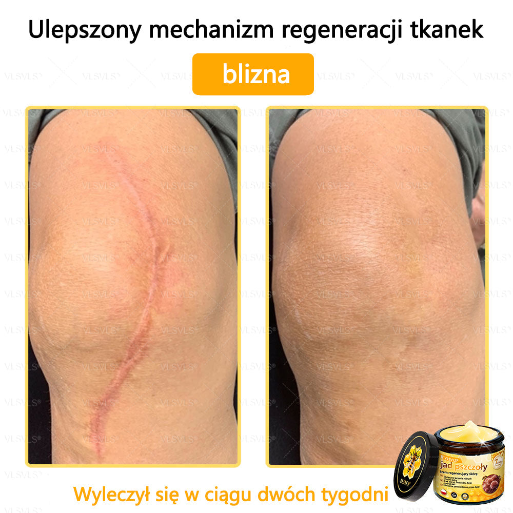 VLSVLS® Krem z jadem pszczelim do regeneracji skóry (👨⚕ odpowiedni dla wszystkich grup wiekowych, polecany przez AAD)