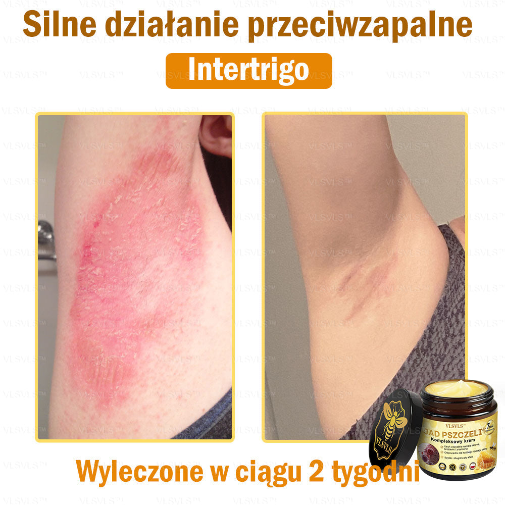 VLSVLS™ Krem Komprehensywny z Jadami Pszczół 👩⚕️ Rekomendowany przez Dermatologów