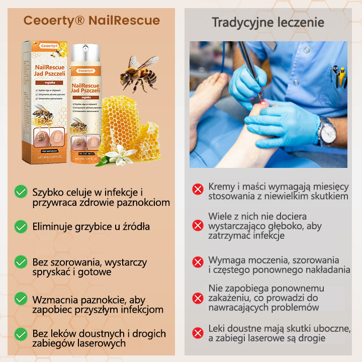 Spray z jadem pszczelim – skuteczny w leczeniu infekcji grzybiczych i zapalenia paznokci🐝