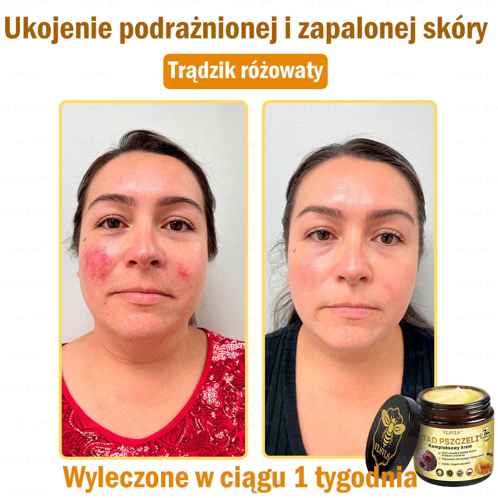 VLSVLS™ Krem Komprehensywny z Jadami Pszczół 👩⚕️ Rekomendowany przez Dermatologów