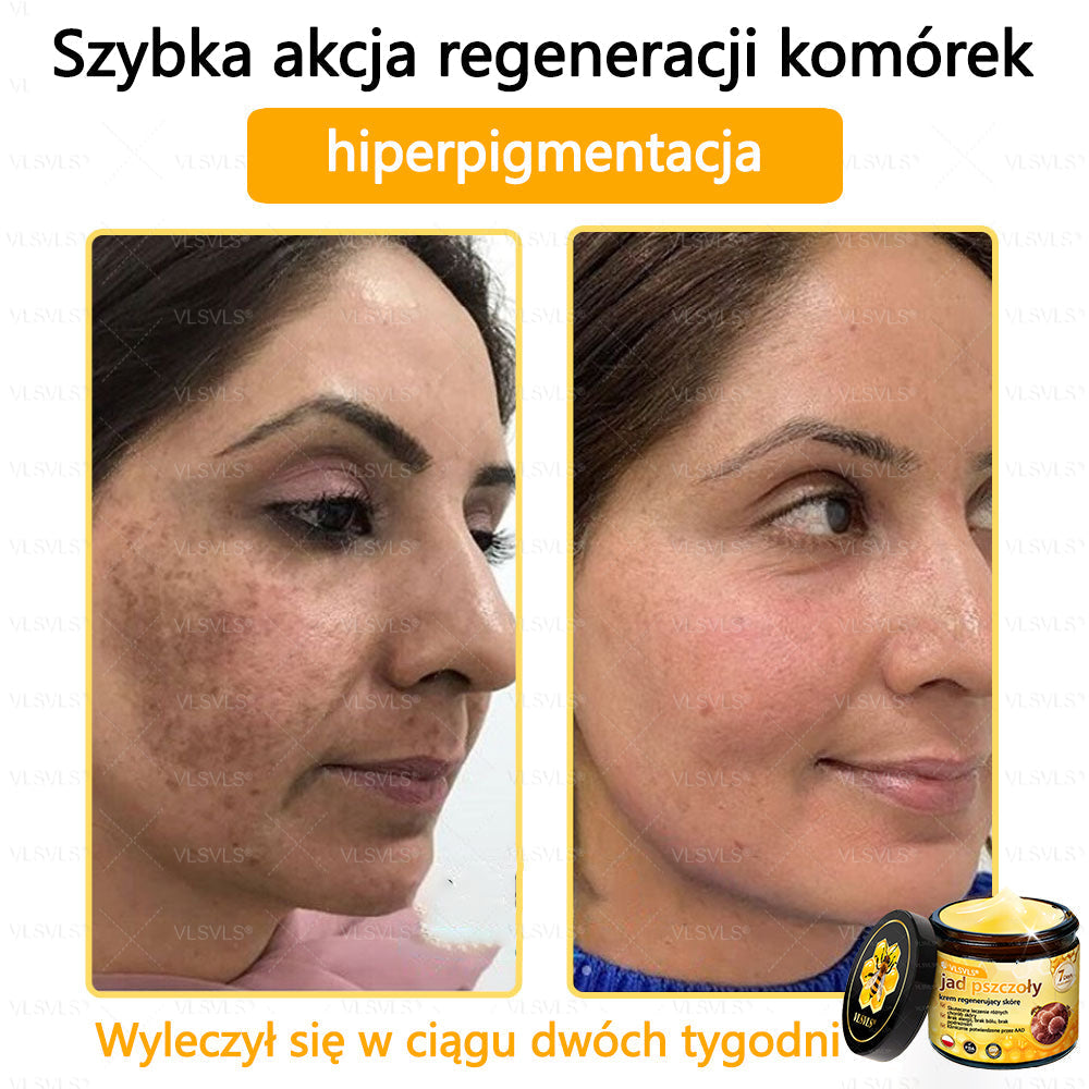 VLSVLS® Krem z jadem pszczelim do regeneracji skóry (👨⚕ odpowiedni dla wszystkich grup wiekowych, polecany przez AAD)