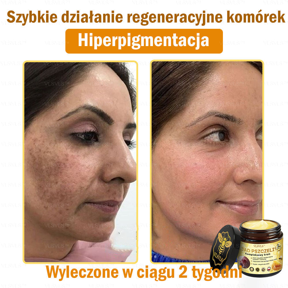 VLSVLS™ Krem Komprehensywny z Jadami Pszczół 👩⚕️ Rekomendowany przez Dermatologów