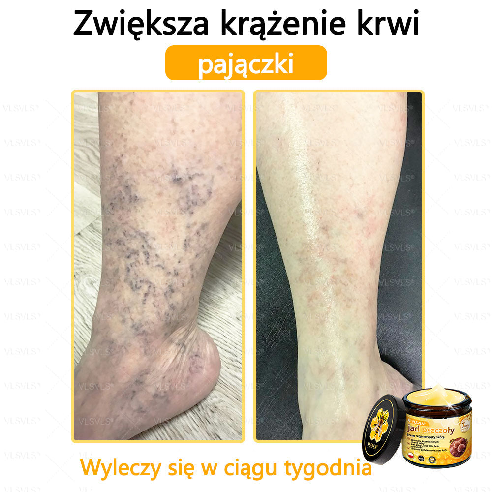 VLSVLS® Krem z jadem pszczelim do regeneracji skóry (👨⚕ odpowiedni dla wszystkich grup wiekowych, polecany przez AAD)