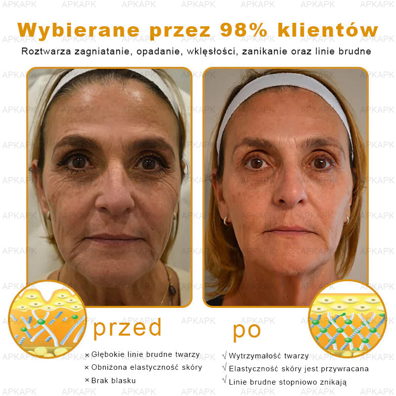 ΑPΚΑPK™ Jad Pszczoły Kompleksowy Krem🥇🥇pomaga w leczeniu problemów skórnych, takich jak: zmarszczki, blizny, plamy pigmentacyjne, rozstępy, trądzik, łuszczyca, egzema, zmiany skórne, podrażnienia, stany zapalne i inne problemy skórne🔥