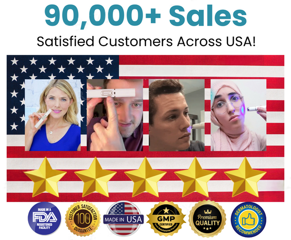 Bikenda®Nieinwazyjny laser do usuwania znamion i brodawek