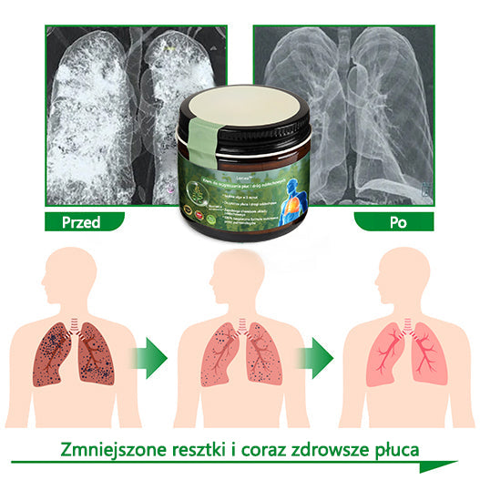 [Noworoczna oferta specjalna] Lercea™ Krem regenerujący płuca z dziewanny - zatwierdzony przez British Thoracic Society w celu wspierania zdrowia płuc👑👑