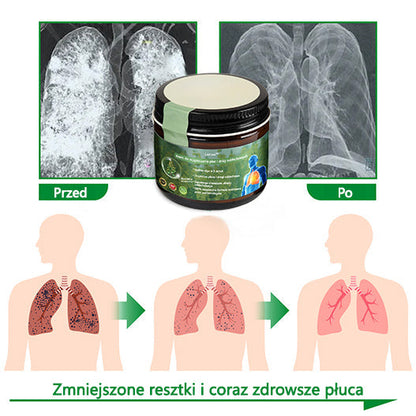 [Noworoczna oferta specjalna] Lercea™ Krem regenerujący płuca z dziewanny - zatwierdzony przez British Thoracic Society w celu wspierania zdrowia płuc👑👑