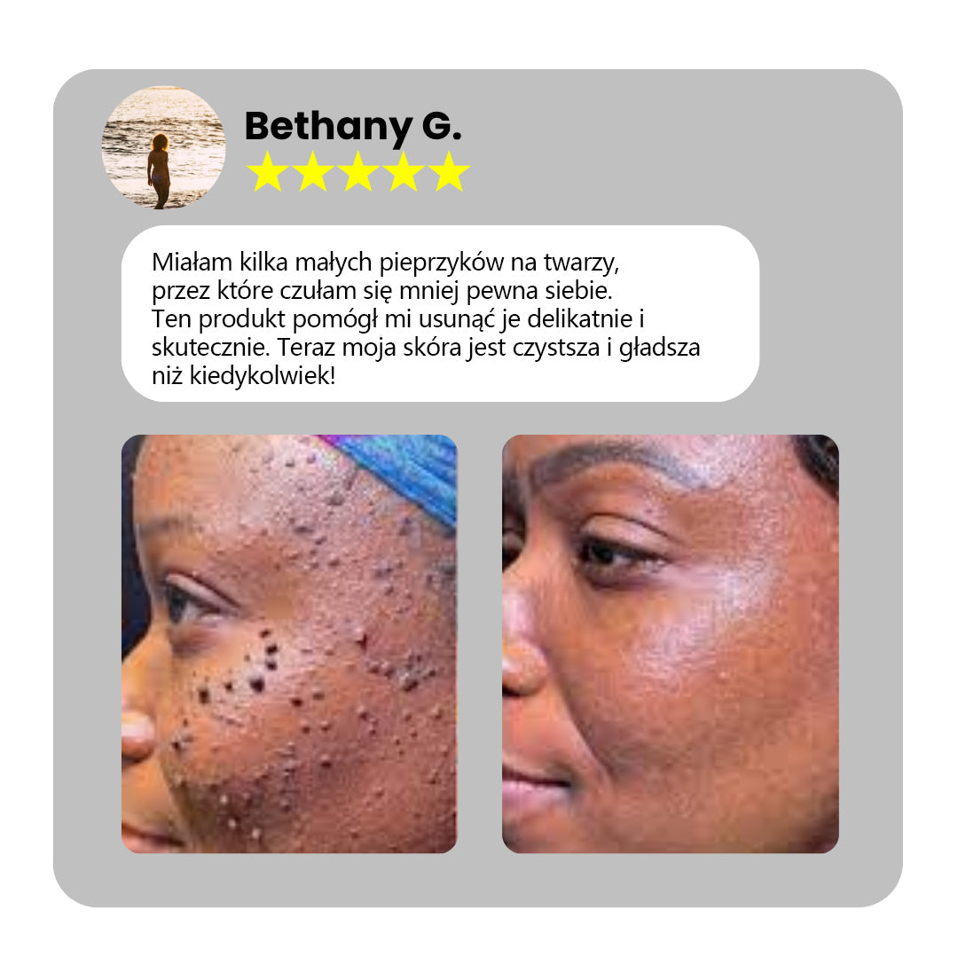 ✅Bikenda® do użytku domowego CO2 Laser Shot Erase Pro