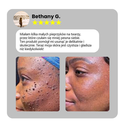 ✅Bikenda® do użytku domowego CO2 Laser Shot Erase Pro