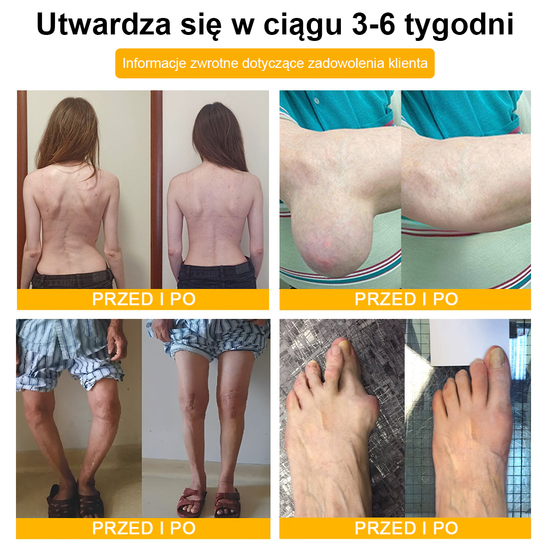 TLOPA® Toksyna botulinowa i jad pszczeli Balsam Łagodzący Ból i Leczenie Kości🐝🌿 (Polecane dla seniorów przez ortopedów)🔥🔥