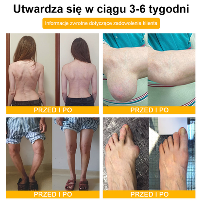 TLOPA® Toksyna botulinowa i jad pszczeli Balsam Łagodzący Ból i Leczenie Kości🐝🌿 (Polecane dla seniorów przez ortopedów)🔥🔥