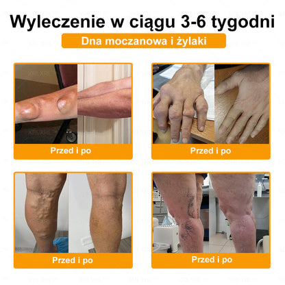 XRLXRL® Jad pszczeli Maść przeciwbólową wspomagającą gojenie kości 🎉🌸(Szczególnie dla osób starszych i zalecane przez EFORT)