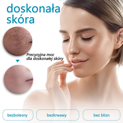 ✅Bikenda® do użytku domowego CO2 Laser Shot Erase Pro