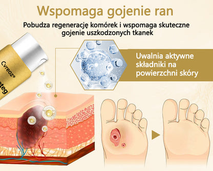 Cvreoz® Leczniczy spray z jadem pszczelim do gojenia i regeneracji ran na dłoniach i stopach🌿