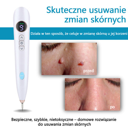 ✅Bikenda® do użytku domowego CO2 Laser Shot Erase Pro