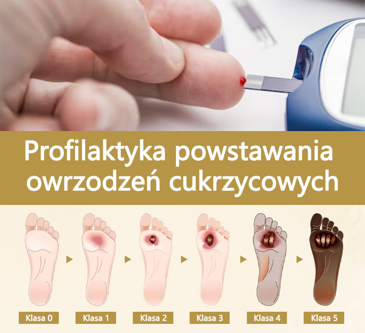 Cvreoz® Leczniczy spray z jadem pszczelim do gojenia i regeneracji ran na dłoniach i stopach🌿