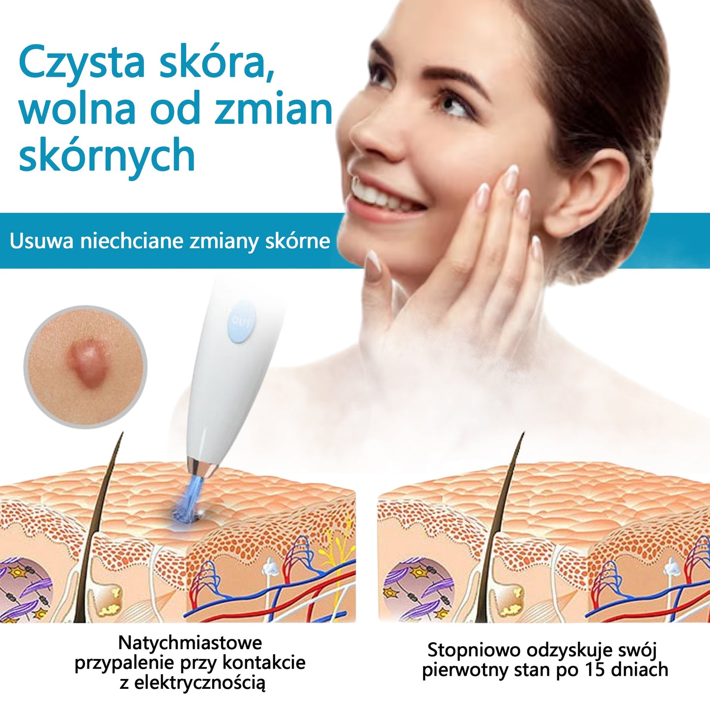 ✅Bikenda® do użytku domowego CO2 Laser Shot Erase Pro