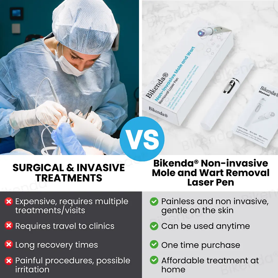 Bikenda®Nieinwazyjny laser do usuwania znamion i brodawek