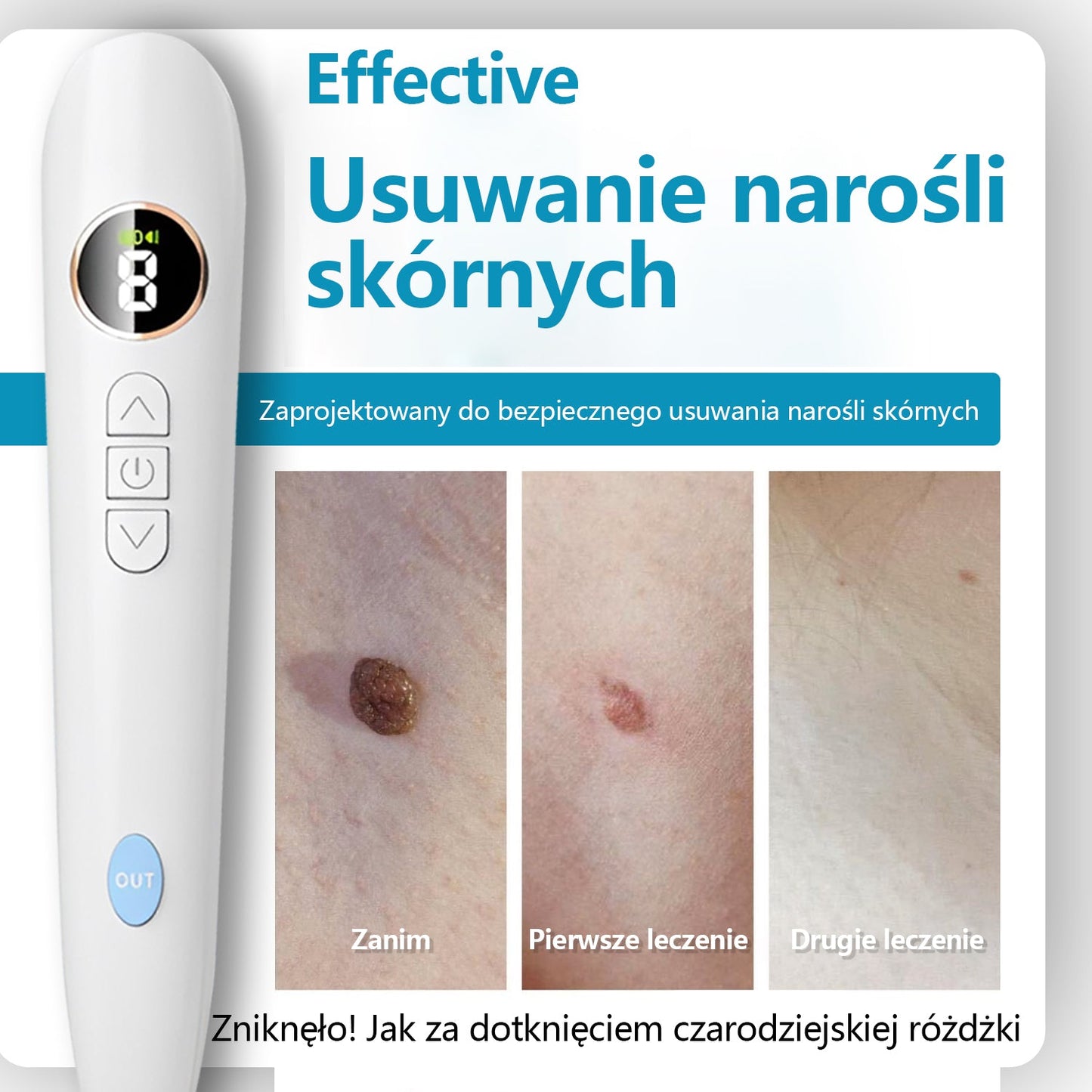 ✅Bikenda® do użytku domowego CO2 Laser Shot Erase Pro