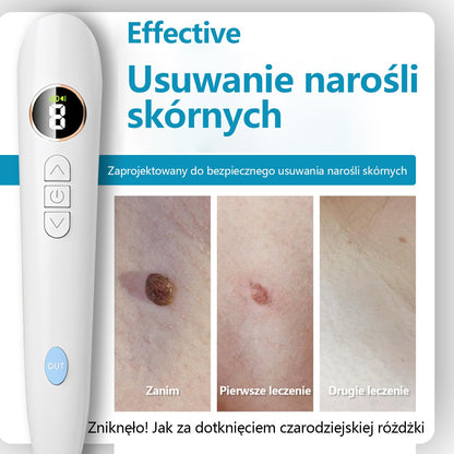 ✅Bikenda® do użytku domowego CO2 Laser Shot Erase Pro